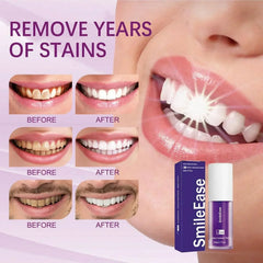 Smile Ease | ابتسامة سهولة